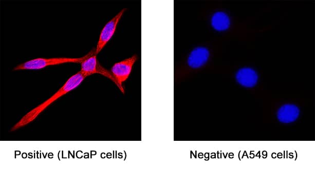 TMPRSS2 was detected in immersion fixed LNCaP human prostate cancer cell line (positive staining) and A549 human lung carcinoma cell line (negative staining) using Mouse Anti-Human TMPRSS2 Monoclonal Antibody (Catalog # MAB10723) at 8 µg/mL for 3 hours at room temperature. Cells were stained using the NorthernLights™ 557-conjugated Anti-Mouse IgG Secondary Antibody (red; NL007) and counterstained with DAPI (blue). Specific staining was localized to cytoplasm. Staining was performed using our protocol for Fluorescent ICC Staining of Non-adherent Cells.