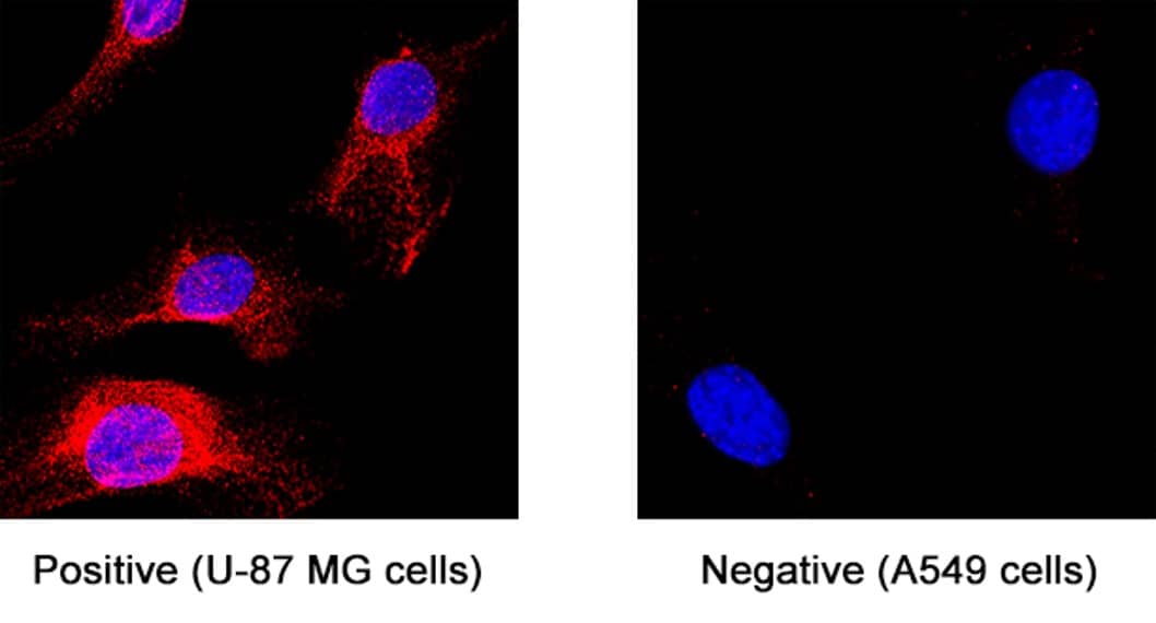 GPR85 was detected in immersion fixed U‑87 MG human glioblastoma/astrocytoma cell line (positive staining) and A549 human lung carcinoma cell line (negative staining) using Mouse Anti-Human GPR85 Monoclonal Antibody (Catalog # MAB10761) at 8 µg/mL for 3 hours at room temperature. Cells were stained using the NorthernLights™ 557-conjugated Anti-Rabbit IgG Secondary Antibody (red; NL004) and counterstained with DAPI (blue). Specific staining was localized to cytoplasm. Staining was performed using our protocol for Fluorescent ICC Staining of Non-adherent Cells.