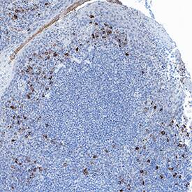 MFAP3 was detected in immersion fixed paraffin-embedded sections of Human Tonsil using Mouse Anti-Human MFAP3 Monoclonal Antibody (Catalog # MAB10798) at 5 µg/mL for 1 hour at room temperature followed by incubation with the Anti-Mouse IgG VisUCyte™ HRP Polymer Antibody (Catalog # VC001). Before incubation with the primary antibody, tissue was subjected to heat-induced epitope retrieval using VisUCyte Antigen Retrieval Reagent-Basic (Catalog # VCTS021). Tissue was stained using DAB (brown) and counterstained with hematoxylin (blue). Specific staining was localized to lymphocytes. View our protocol for IHC Staining with VisUCyte HRP Polymer Detection Reagents.