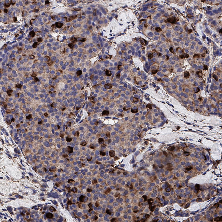 Immunohistochemistry Cathepsin V Antibody (182016) [Unconjugated]