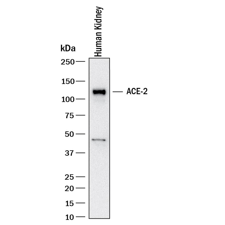 Western blot shows lysates of human kidney. PVDF membrane was probed with 2 µg/mL of Mouse Anti-Human ACE‑2 Monoclonal Antibody (Catalog # MAB10821) followed by HRP-conjugated Anti-Mouse IgG Secondary Antibody (HAF018). A specific band was detected for ACE‑2 at approximately 120 kDa (as indicated). This experiment was conducted under reducing conditions and using Western Blot Buffer Group 1.