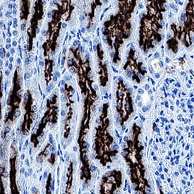 ACE‑2 was detected in immersion fixed paraffin-embedded sections of human kidney using Mouse Anti-Human ACE‑2 Monoclonal Antibody (Catalog # MAB10826) at 5 µg/mL for 1 hour at room temperature followed by incubation with the Anti-Mouse IgG VisUCyte™ HRP Polymer Antibody (VC001). Before incubation with the primary antibody, tissue was subjected to heat-induced epitope retrieval using Antigen Retrieval Reagent-Basic (CTS013). Tissue was stained using DAB (brown) and counterstained with hematoxylin (blue). Specific staining was localized to cell membranes in convoluted tubules. Staining was performed using our protocol for IHC Staining with VisUCyte HRP Polymer Detection Reagents.