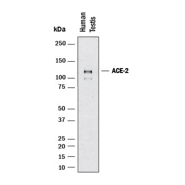 Western blot shows lysates of human testis. PVDF membrane was probed with 2 µg/mL of Mouse Anti-Human ACE‑2 Monoclonal Antibody (Catalog # MAB10826) followed by HRP-conjugated Anti-Mouse IgG Secondary Antibody (HAF018). A specific band was detected for ACE‑2 at approximately 120 kDa (as indicated). This experiment was conducted under reducing conditions and using Western Blot Buffer Group 1.