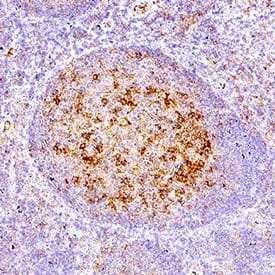 PD‑1 was detected in immersion fixed paraffin-embedded sections of human tonsil using Rabbit Anti-Human PD‑1 Monoclonal Antibody (Catalog # MAB10858) at 3 µg/mL for 1 hour at room temperature followed by incubation with the Anti-Rabbit IgG VisUCyte™ HRP Polymer Antibody (VC003). Before incubation with the primary antibody, tissue was subjected to heat-induced epitope retrieval using Antigen Retrieval Reagent-Basic (CTS013). Tissue was stained using DAB (brown) and counterstained with hematoxylin (blue). Specific staining was localized to lymphocytes in germinal centers. Staining was performed using our protocol for IHC Staining with VisUCyte HRP Polymer Detection Reagents.