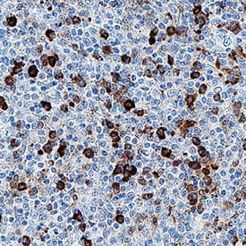 PD‑1 was detected in immersion fixed paraffin-embedded sections of human tonsil using Mouse Anti-Human PD‑1 Monoclonal Antibody (Catalog # MAB10865) at 5 µg/mL for 1 hour at room temperature followed by incubation with the Anti-Mouse IgG VisUCyte™ HRP Polymer Antibody VC001. Before incubation with the primary antibody, tissue was subjected to heat-induced epitope retrieval using Antigen Retrieval Reagent-Basic CTS013. Tissue was stained using DAB (brown) and counterstained with hematoxylin (blue). Specific staining was localized to cytoplasm in lymphocytes. Staining was performed using our IHC Staining with VisUCyte HRP Polymer Detection Reagents Protocol.