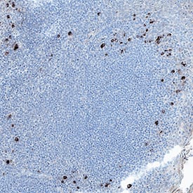 PD‑1 was detected in immersion fixed paraffin-embedded sections of human tonsil tissue using Mouse Anti-Human PD‑1 Monoclonal Antibody (Catalog # MAB10867) at 5 µg/mL for 1 hour at room temperature followed by incubation with the Anti-Mouse IgG VisUCyte™ HRP Polymer Antibody (VC001). Before incubation with the primary antibody, tissue was subjected to heat-induced epitope retrieval using Antigen Retrieval Reagent-Basic (CTS013). Tissue was stained using DAB (brown) and counterstained with hematoxylin (blue). Specific staining was localized to lymphocytes. Staining was performed using our protocol for IHC Staining with VisUCyte HRP Polymer Detection Reagents.