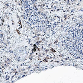 SARS-CoV-2 Envelope was detected in immersion fixed paraffin-embedded sections of SARS-CoV-2 infected human lung using Mouse Anti-SARS-CoV-2 Envelope Monoclonal Antibody (Catalog # MAB10925) at 5 µg/mL for 1 hour at room temperature followed by incubation with the Anti-Mouse IgG VisUCyte™  HRP Polymer Antibody (VC001). Before incubation with the primary antibody, tissue was subjected to heat-induced epitope retrieval using Antigen Retrieval Reagent-Basic  (CTS013). Tissue was stained using DAB (brown) and counterstained with hematoxylin (blue).  Specific staining was localized to immunoreactive profiles scattered throughout the tissue. Staining was performed using our protocol for IHC Staining with VisUCyte HRP Polymer Detection Reagents.