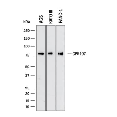 Western Blot GPR107 Antibody (1040717) [Unconjugated]
