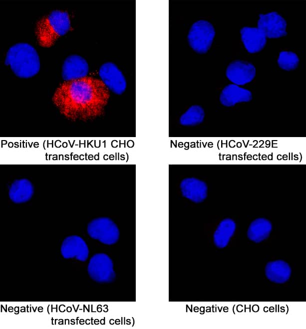 Spike RBD was detected in immersion fixed CHO Chinese hamster ovary cell line transfected with HCoV-HKU1 (positive staining), HCoV-229E transfected (negative staining), HCoV-NL63 transfected cell (negative staining), and CHO Chinese hamster ovary cell line (non-transfected, negative staining) using Mouse Anti-HCoV-HKU1 Spike RBD Monoclonal Antibody (Catalog # MAB10936) at 8 µg/mL for 3 hours at room temperature. Cells were stained using the NorthernLights™ 557-conjugated Anti-Mouse IgG Secondary Antibody (red; NL007) and counterstained with DAPI (blue). Specific staining was localized to cell cytoplasm. Staining was performed using our protocol for Fluorescent ICC Staining of Non-adherent Cells.