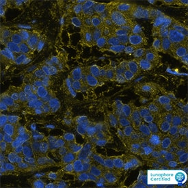 HER2 was detected in immersion fixed paraffin-embedded sections of human breast cancer using Mouse Anti-Human ErbB2/HER2 Monoclonal Antibody (Catalog # MAB11291) at 12ug/mL at 37 ° Celsius for 4 minutes. Before incubation with the primary antibody, tissue underwent an all-in-one dewaxing and antigen retrieval preprocessing using PreTreatment Module (PT Module) and Dewax and HIER Buffer H (pH 9). Tissue was stained using the Alexa Fluor™ 647 Goat anti-Mouse IgG Secondary Antibody at 1:200 at 37 ° Celsius for 2 minutes. (Yellow; Lunaphore Catalog # DR647MS) and counterstained with DAPI (blue; Lunaphore Catalog # DR100). Specific staining was localized to the cytoplasm. Protocol available in COMET™ Panel Builder.​