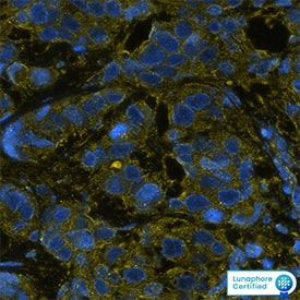 HER2 was detected in immersion fixed paraffin-embedded sections of human breast cancer using Mouse Anti-Human ErbB2/HER2 Monoclonal Antibody (Catalog # MAB11291) at 12ug/mL at 37 ° Celsius for 4 minutes. Before incubation with the primary antibody, tissue underwent an all-in-one dewaxing and antigen retrieval preprocessing using PreTreatment Module (PT Module) and Dewax and HIER Buffer H (pH 9). Tissue was stained using the Alexa Fluor™ 647 Goat anti-Mouse IgG Secondary Antibody at 1:200 at 37 ° Celsius for 2 minutes. (Yellow; Lunaphore Catalog # DR647MS) and counterstained with DAPI (blue; Lunaphore Catalog # DR100). Specific staining was localized to the cytoplasm. Protocol available in COMET™ Panel Builder.​