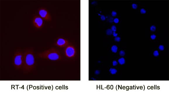MFAP3L was detected in immersion fixed RT‑4 human urinary bladder transitional cell papilloma cell line (Positive) & absent in HL‑60 human acute promyelocytic leukemia cell line (Negative) using Mouse Anti-Human MFAP3L Monoclonal Antibody (Catalog # MAB11325) at 8 µg/mL for 3 hours at room temperature. Cells were stained using the NorthernLights™ 557-conjugated Anti-Mouse IgG Secondary Antibody (red; Catalog # NL007) and counterstained with DAPI (blue). Specific staining was localized to cytoplasm. View our protocol for Fluorescent ICC Staining of Cells on Coverslips.