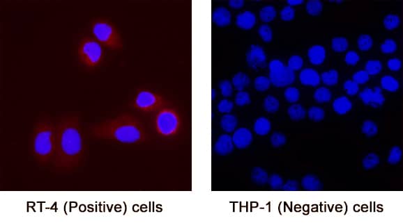 MFAP3L was detected in immersion fixed RT‑4 human urinary bladder transitional cell papilloma cell line (Positive) & absent in THP‑1 human acute monocytic leukemia cell line (Negative) using Mouse Anti-Human MFAP3L Monoclonal Antibody (Catalog # MAB11325) at 8 µg/mL for 3 hours at room temperature. Cells were stained using the NorthernLights™ 557-conjugated Anti-Mouse IgG Secondary Antibody (red; Catalog # NL007) and counterstained with DAPI (blue). Specific staining was localized to cytoplasm. View our protocol for Fluorescent ICC Staining of Cells on Coverslips.