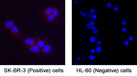 MFAP3L was detected in immersion fixed SK‑BR‑3 human breast cancer cell line (Positive) & absent in HL‑60 human acute promyelocytic leukemia cell line (Negative) using Mouse Anti-Human MFAP3L Monoclonal Antibody (Catalog # MAB11325) at 8 µg/mL for 3 hours at room temperature. Cells were stained using the NorthernLights™ 557-conjugated Anti-Mouse IgG Secondary Antibody (red; Catalog # NL007) and counterstained with DAPI (blue). Specific staining was localized to cytoplasm. View our protocol for Fluorescent ICC Staining of Cells on Coverslips.