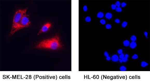  alpha -Synuclein was detected in immersion fixed SK‑Mel‑28 human malignant melanoma cells (positive) and absent in HL‑60 human acute promyelocytic leukemia cells (negative) using Mouse Anti-Human  alpha -Synuclein Monoclonal Antibody (Catalog # MAB11376) at 8 µg/mL for 3 hours at room temperature. Cells were stained using the NorthernLights™ 557-conjugated Anti-Rat IgG Secondary Antibody (red; Catalog # NL013) and counterstained with DAPI (blue). Specific staining was localized to cytoplasm. View our protocol for Fluorescent ICC Staining of Cells on Coverslips.