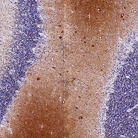  alpha -Synuclein was detected in immersion fixed paraffin-embedded sections of Human Brain Cerebellum using Mouse Anti-Human  alpha -Synuclein Monoclonal Antibody (Catalog # MAB11376) at 5 µg/mL for 1 hour at room temperature followed by incubation with the Anti-Mouse IgG VisUCyte™ HRP Polymer Antibody (Catalog # VC001). Before incubation with the primary antibody, tissue was subjected to heat-induced epitope retrieval using VisUCyte Antigen Retrieval Reagent-Basic (Catalog # VCTS021). Tissue was stained using DAB (brown) and counterstained with hematoxylin (blue). Specific staining was localized to medulla. View our protocol for IHC Staining with VisUCyte HRP Polymer Detection Reagents.