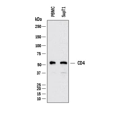 Western blot shows lysates of PBMC, SUP‑T1 human T cell lymphoblastic lymphoma cells. PVDF membrane was probed with 2 µg/mL of Mouse Anti-Human CD4 Monoclonal Antibody (Catalog # MAB11426) followed by HRP-conjugated Anti-Mouse IgG Secondary Antibody (Catalog # HAF018). A specific band was detected for CD4 at approximately 55 kDa (as indicated). This experiment was conducted under reducing conditions and using Western Blot Buffer Group 1.