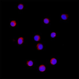 VHL was detected in formalin fixed Daudi human Burkitt's lymphoma cell line using Mouse Anti-Human VHL Monoclonal Antibody (Catalog # MAB114352) at 8 µg/ml for 3 hours at room temperature. Cells were stained using the NorthernLights™ 557-conjugated Anti-Mouse IgG Secondary Antibody (red; Catalog # NL007) and counterstained with DAPI (blue). Specific staining was localized to the membrane. View our protocol for Fluorescent ICC Staining of Non-adherent Cells.