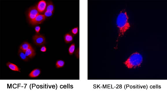 Isocitrate Dehydrogenase 2/IDH2 was detected in fixed MCF‑7 human breast cancer cell line (Positive) and SK‑Mel‑28 human malignant melanoma cell line (Positive) using Mouse Anti-Human Isocitrate Dehydrogenase 2/IDH2 Monoclonal Antibody (Catalog # MAB11462) at 8 µg/ml for 3 hours at room temperature. Cells were stained using the NorthernLights™ 557-conjugated Anti-Mouse IgG Secondary Antibody (red; Catalog # NL007) and counterstained with DAPI (blue). Specific staining was localized to the cytoplasm and membrane. View our protocol for Fluorescent ICC Staining of Cells on Coverslips.