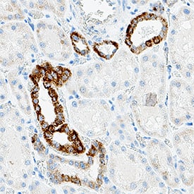 Isocitrate Dehydrogenase 2/IDH2 was detected in immersion fixed paraffin-embedded sections of human kidney using Mouse Anti-Human Isocitrate Dehydrogenase 2/IDH2 Monoclonal Antibody (Catalog # MAB11462) at 5 µg/ml for 1 hour at room temperature followed by incubation with the Anti-Mouse IgG VisUCyte™ HRP Polymer Antibody (Catalog # VC001). Before incubation with the primary antibody, tissue was subjected to heat-induced epitope retrieval using VisUCyte Antigen Retrieval Reagent-Basic (Catalog # VCTS021). Tissue was stained using DAB (brown) and counterstained with hematoxylin (blue). Specific staining was localized to the cytoplasm and kidney tubules. View our protocol for Chromogenic IHC Staining of Paraffin-embedded Tissue Sections.