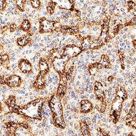 HLA Class I was detected in immersion fixed paraffin-embedded sections of human spleen using Mouse Anti-Human HLA Class I Monoclonal Antibody (Catalog # MAB11502) at 1.7 µg/ml for 1 hour at room temperature followed by incubation with the HRP-conjugated Anti-Mouse IgG Secondary Antibody (Catalog # HAF007) or the Anti-Mouse IgG VisUCyte™ HRP Polymer Antibody (Catalog # VC001). Before incubation with the primary antibody, tissue was subjected to heat-induced epitope retrieval using VisUCyte Antigen Retrieval Reagent-Basic (Catalog # VCTS021). Tissue was stained using DAB (brown) and counterstained with hematoxylin (blue). Specific staining was localized to endothelial cells. View our protocol for Chromogenic IHC Staining of Paraffin-embedded Tissue Sections.