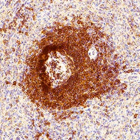 Siglec‑2/CD22 was detected in immersion fixed paraffin-embedded sections of human spleen using Mouse Anti-Human Siglec‑2/CD22 Monoclonal Antibody (Catalog # MAB11515) at 5 µg/ml for 1 hour at room temperature followed by incubation with the HRP-conjugated Anti-Mouse IgG Secondary Antibody (Catalog # HAF007) or the Anti-Mouse IgG VisUCyte™ HRP Polymer Antibody (Catalog # VC001). Before incubation with the primary antibody, tissue was subjected to heat-induced epitope retrieval using VisUCyte Antigen Retrieval Reagent-Basic (Catalog # VCTS021). Tissue was stained using DAB (brown) and counterstained with hematoxylin (blue). Specific staining was localized to the membrane of the germinal centers. View our protocol for Chromogenic IHC Staining of Paraffin-embedded Tissue Sections.