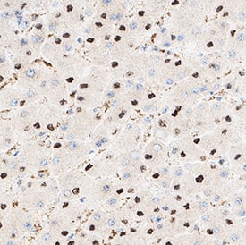 Histone H2AX was detected in immersion fixed paraffin-embedded sections of human liver using Mouse Anti-Human Histone H2AX Monoclonal Antibody (Catalog # MAB11529) at 5 µg/ml for 1 hour at room temperature followed by incubation with the HRP-conjugated Anti-Mouse IgG Secondary Antibody (Catalog # HAF007) or the Anti-Mouse IgG VisUCyte™ HRP Polymer Antibody (Catalog # VC001). Before incubation with the primary antibody, tissue was subjected to heat-induced epitope retrieval using VisUCyte Antigen Retrieval Reagent-Basic (Catalog # VCTS021). Tissue was stained using DAB (brown) and counterstained with hematoxylin (blue). Specific staining was localized to the nucleus. View our protocol for Chromogenic IHC Staining of Paraffin-embedded Tissue Sections.