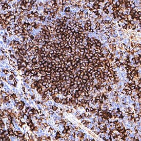 HLA‑DR was detected in immersion fixed paraffin-embedded sections of human tonsil using Mouse Anti-Human HLA‑DR Monoclonal Antibody (Catalog # MAB11555) at 1 µg/ml for 1 hour at room temperature followed by incubation with the Anti-Mouse IgG VisUCyte™ HRP Polymer Antibody (Catalog # VC001) or the HRP-conjugated Anti-Mouse IgG Secondary Antibody (Catalog # HAF007). Before incubation with the primary antibody, tissue was subjected to heat-induced epitope retrieval using VisUCyte Antigen Retrieval Reagent-Basic (Catalog # VCTS021). Tissue was stained using DAB (brown) and counterstained with hematoxylin (blue). Specific staining was localized to the membrane. View our protocol for Chromogenic IHC Staining of Paraffin-embedded Tissue Sections.