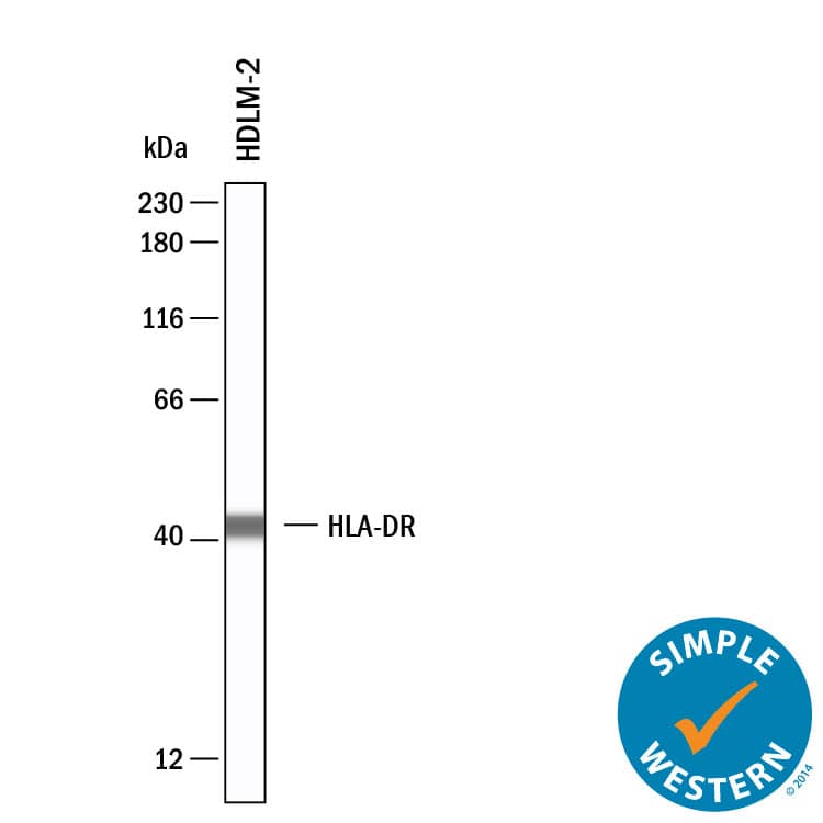 Simple Western shows lysates of HDLM‑2 human Hodgkin’s lymphoma cell line, loaded at 1 mg/ml. A specific band was detected for HLA‑DR at approximately 42 kDa (as indicated) using 20 µg/mL of Mouse Anti-Human HLA‑DR Monoclonal Antibody (Catalog # MAB11555). This experiment was conducted under reducing conditions and using the 12‑230 kDa separation system.