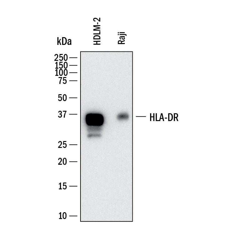 Western Blot shows lysates of HDLM‑2 human Hodgkin’s lymphoma cell line and Raji human Burkitt's lymphoma cell line. PVDF membrane was probed with 2 µg/ml of Mouse Anti-Human HLA‑DR Monoclonal Antibody (Catalog # MAB11555) followed by HRP-conjugated Anti-Mouse IgG Secondary Antibody (Catalog # HAF018). A specific band was detected for HLA‑DR at approximately 35 kDa (as indicated).  This experiment was conducted under reducing conditions and using Western Blot Buffer Group 1.