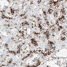 ATP5A1 was detected in immersion fixed paraffin-embedded sections of human liver using Mouse Anti-Human ATP5A1 Monoclonal Antibody (Catalog # MAB11558) at 5 µg/ml for 1 hour at room temperature followed by incubation with the Anti-Mouse IgG VisUCyte™ HRP Polymer Antibody (Catalog # VC001) or the HRP-conjugated Anti-Mouse IgG Secondary Antibody (Catalog # HAF007). Before incubation with the primary antibody, tissue was subjected to heat-induced epitope retrieval using VisUCyte Antigen Retrieval Reagent-Basic (Catalog # VCTS021). Tissue was stained using DAB (brown) and counterstained with hematoxylin (blue). Specific staining was localized to the membrane of mitochondria. View our protocol for Chromogenic IHC Staining of Paraffin-embedded Tissue Sections.