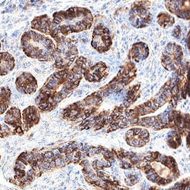 PIEZO2 was detected in immersion fixed paraffin-embedded sections of human breast using Mouse Anti-Human PIEZO2 Monoclonal Antibody (Catalog # MAB11559) at 0.05 µg/ml for 1 hour at room temperature followed by incubation with the Anti-Mouse IgG VisUCyte™ HRP Polymer Antibody (Catalog # VC001). Before incubation with the primary antibody, tissue was subjected to heat-induced epitope retrieval using VisUCyte Antigen Retrieval Reagent-Basic (Catalog # VCTS021). Tissue was stained using DAB (brown) and counterstained with hematoxylin (blue). Specific staining was localized to the cell surface. View our protocol for IHC Staining with VisUCyte HRP Polymer Detection Reagents.