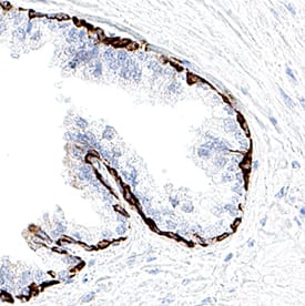 Cytokeratin 17/19 was detected in immersion fixed paraffin-embedded sections of human prostate using Mouse Anti-Human Cytokeratin 17/19 Monoclonal Antibody (Catalog # MAB11568) at 5 µg/ml for 1 hour at room temperature followed by incubation with the Anti-Mouse IgG VisUCyte&trade; HRP Polymer Antibody (Catalog # VC001) or the HRP-conjugated Anti-Mouse IgG Secondary Antibody (Catalog # HAF007). Before incubation with the primary antibody, tissue was subjected to heat-induced epitope retrieval using VisUCyte Antigen Retrieval Reagent-Basic (Catalog # VCTS021). Tissue was stained using DAB (brown) and counterstained with hematoxylin (blue). Specific staining was localized to the membrane of basal cells. View our protocol for Chromogenic IHC Staining of Paraffin-embedded Tissue Sections.