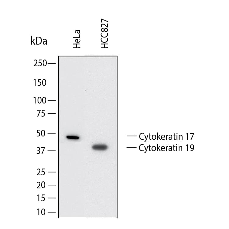 Western Blot shows lysates of HeLa human cervical epithelial carcinoma cell line and HCC827 human non-small cell lung cancer cell line. PVDF membrane was probed with 2 µg/ml of Mouse Anti-Human Cytokeratin 17/19 Monoclonal Antibody (Catalog # MAB11568) followed by HRP-conjugated Anti-Mouse IgG Secondary Antibody (Catalog # HAF018). Specific bands were detected for Cytokeratin 17 at approximately 48 kDa and for Cytokeratin 19 at approximately 41 kDa (as indicated).  This experiment was conducted under reducing conditions and using Western Blot Buffer Group 1.