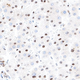 TCEB1 was detected in immersion fixed paraffin-embedded sections of human liver using Mouse Anti-Human TCEB1 Monoclonal Antibody (Catalog # MAB11569) at 5 µg/ml for 1 hour at room temperature followed by incubation with the Anti-Mouse IgG VisUCyte™ HRP Polymer Antibody (Catalog # VC001) or the HRP-conjugated Anti-Mouse IgG Secondary Antibody (Catalog # HAF007). Before incubation with the primary antibody, tissue was subjected to heat-induced epitope retrieval using VisUCyte Antigen Retrieval Reagent-Basic (Catalog # VCTS021). Tissue was stained using DAB (brown) and counterstained with hematoxylin (blue). Specific staining was localized to the nucleus. View our protocol for Chromogenic IHC Staining of Paraffin-embedded Tissue Sections.