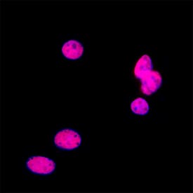 TCEB1 was detected in fixed MCF‑7 human breast cancer cell line using Mouse Anti-Human TCEB1 Monoclonal Antibody (Catalog # MAB11569) at 8 µg/ml for 3 hours at room temperature. Cells were stained using the NorthernLights™ 557-conjugated Anti-Mouse IgG Secondary Antibody (red; Catalog # NL007) and counterstained with DAPI (blue). Specific staining was localized to the nucleus. View our protocol for Fluorescent ICC Staining of Cells on Coverslips.