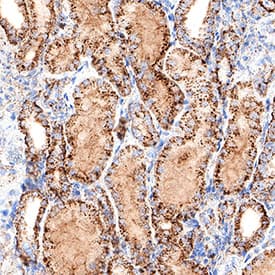 CPT1A was detected in immersion fixed paraffin-embedded sections of human kidney using Mouse Anti-Human CPT1A Monoclonal Antibody (Catalog # MAB11570) at 5 µg/ml for 1 hour at room temperature followed by incubation with the Anti-Mouse IgG VisUCyte™ HRP Polymer Antibody (Catalog # VC001) or the HRP-conjugated Anti-Mouse IgG Secondary Antibody (Catalog # HAF007). Before incubation with the primary antibody, tissue was subjected to heat-induced epitope retrieval using VisUCyte Antigen Retrieval Reagent-Basic (Catalog # VCTS021). Tissue was stained using DAB (brown) and counterstained with hematoxylin (blue). Specific staining was localized to the cytoplasm. View our protocol for Chromogenic IHC Staining of Paraffin-embedded Tissue Sections.