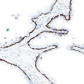 Cytokeratin 17 was detected in immersion fixed paraffin-embedded sections of human prostate using Mouse Anti-Human Cytokeratin 17 Monoclonal Antibody (Catalog # MAB11571) at 5 µg/ml for 1 hour at room temperature followed by incubation with the Anti-Mouse IgG VisUCyte™ HRP Polymer Antibody (Catalog # VC001) or the HRP-conjugated Anti-Mouse IgG Secondary Antibody (Catalog # HAF007). Before incubation with the primary antibody, tissue was subjected to heat-induced epitope retrieval using VisUCyte Antigen Retrieval Reagent-Basic (Catalog # VCTS021). Tissue was stained using DAB (brown) and counterstained with hematoxylin (blue). Specific staining was localized to the cytoplasm. View our protocol for Chromogenic IHC Staining of Paraffin-embedded Tissue Sections.