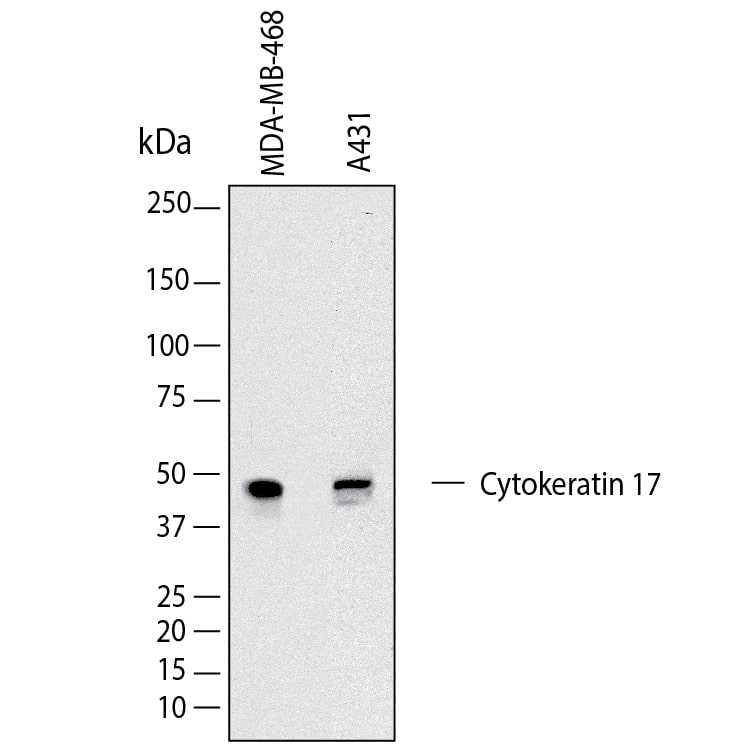 Western Blot shows lysates of MDA‑MB‑468 human breast cancer cell line and A431 human epithelial carcinoma cell line. PVDF membrane was probed with 2 µg/ml of Mouse Anti-Human Cytokeratin 17 Monoclonal Antibody (Catalog # MAB11571) followed by HRP-conjugated Anti-Mouse IgG Secondary Antibody (Catalog # HAF018). A specific band was detected for Cytokeratin 17 at approximately 53 kDa (as indicated).  This experiment was conducted under reducing conditions and using Western Blot Buffer Group 1.