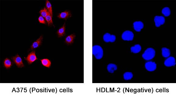 CD163 was detected in immersion fixed A375 human melanoma cell line and not detected in HDLM‑2 human Hodgkin’s lymphoma cell line using Mouse Anti-Human CD163 Monoclonal Antibody (Catalog # MAB11580) at 8 µg/ml for 3 hours at room temperature. Cells were stained using the NorthernLights™ 557-conjugated Anti-Mouse IgG Secondary Antibody (red; Catalog # NL007) and counterstained with DAPI (blue). Specific staining was localized to the cytoplasm. View our protocol for Fluorescent ICC Staining of Cells on Coverslips.