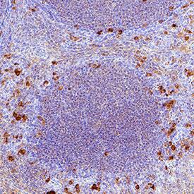 CD45 was detected in immersion fixed paraffin-embedded sections of human tonsil using Mouse Anti-Human CD45RO Monoclonal Antibody (Catalog # mab11594) at 5 µg/ml for 1 hour at room temperature followed by incubation with the Anti-Mouse IgG VisUCyte&trade; HRP Polymer Antibody (Catalog # VC001). Before incubation with the primary antibody, tissue was subjected to heat-induced epitope retrieval using VisUCyte Antigen Retrieval Reagent-Basic (Catalog # VCTS021). Tissue was stained using DAB (brown) and counterstained with hematoxylin (blue). Specific staining was localized to the cell surface. View our protocol for IHC Staining with VisUCyte HRP Polymer Detection Reagents.