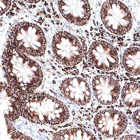 CKAP4/p63 was detected in immersion fixed paraffin-embedded sections of human colon using Mouse Anti-Human CKAP4/p63 Monoclonal Antibody (Catalog # MAB11600) at 5&amp;nbsp;µg/ml for 1 hour at room temperature followed by incubation with the Anti-Mouse IgG VisUCyte&amp;trade; HRP Polymer Antibody (Catalog&amp;#160;# &lt;a class=NoLineLink href=