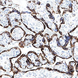 CKAP4/p63 was detected in immersion fixed paraffin-embedded sections of human placenta using Mouse Anti-Human CKAP4/p63 Monoclonal Antibody (Catalog # MAB11600) at 5 µg/ml for 1 hour at room temperature followed by incubation with the Anti-Mouse IgG VisUCyte™ HRP Polymer Antibody (Catalog # VC001). Before incubation with the primary antibody, tissue was subjected to heat-induced epitope retrieval using VisUCyte Antigen Retrieval Reagent-Basic (Catalog # VCTS021). Tissue was stained using DAB (brown) and counterstained with hematoxylin (blue). Specific staining was localized to the cell surface and cytoplasm. View our protocol for IHC Staining with VisUCyte HRP Polymer Detection Reagents.