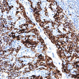 CKAP4/p63 was detected in immersion fixed paraffin-embedded sections of human tonsil using Mouse Anti-Human CKAP4/p63 Monoclonal Antibody (Catalog # MAB11600) at 5 µg/ml for 1 hour at room temperature followed by incubation with the Anti-Mouse IgG VisUCyte™ HRP Polymer Antibody (Catalog # VC001). Before incubation with the primary antibody, tissue was subjected to heat-induced epitope retrieval using VisUCyte Antigen Retrieval Reagent-Basic (Catalog # VCTS021). Tissue was stained using DAB (brown) and counterstained with hematoxylin (blue). Specific staining was localized to the cell surface and cytoplasm. View our protocol for IHC Staining with VisUCyte HRP Polymer Detection Reagents.