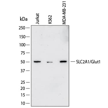 Western Blot shows lysates of Jurkat human acute T cell leukemia cell line, K562 human chronic myelogenous leukemia cell line and MDA‑MB‑231 human breast cancer cell line. PVDF membrane was probed with 2 µg/ml of Mouse Anti-Human Glut1 Monoclonal Antibody (Catalog # MAB11601) followed by HRP-conjugated Anti-Mouse IgG Secondary Antibody (Catalog # HAF018). A specific band was detected for Glut1 at approximately 52 kDa (as indicated).  This experiment was conducted under reducing conditions and using Western Blot Buffer Group 1.