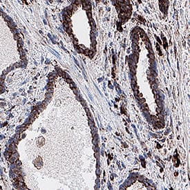 SLC1A5 was detected in immersion fixed paraffin-embedded sections of human prostate using Mouse Anti-Human SLC1A5 Monoclonal Antibody (Catalog # mab11603) at 0.1 µg/ml for 1 hour at room temperature followed by incubation with the Anti-Mouse IgG VisUCyte™ HRP Polymer Antibody (Catalog # VC001). Before incubation with the primary antibody, tissue was subjected to heat-induced epitope retrieval using VisUCyte Antigen Retrieval Reagent-Basic (Catalog # VCTS021). Tissue was stained using DAB (brown) and counterstained with hematoxylin (blue). Specific staining was localized to the cell membrane of glandular cells. View our protocol for IHC Staining with VisUCyte HRP Polymer Detection Reagents.