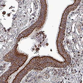 TOMM20 was detected in immersion fixed paraffin-embedded sections of human lung using Mouse Anti-Human TOMM20 Monoclonal Antibody (Catalog # MAB11604) at 5 µg/ml for 1 hour at room temperature followed by incubation with the Anti-Mouse IgG VisUCyte™ HRP Polymer Antibody (Catalog # VC001). Before incubation with the primary antibody, tissue was subjected to heat-induced epitope retrieval using VisUCyte Antigen Retrieval Reagent-Basic (Catalog # VCTS021). Tissue was stained using DAB (brown) and counterstained with hematoxylin (blue). Specific staining was localized to the cytoplasm of bronchial epithelium. View our protocol for IHC Staining with VisUCyte HRP Polymer Detection Reagents.
