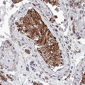 TOMM20 was detected in immersion fixed paraffin-embedded sections of human testis using Mouse Anti-Human TOMM20 Monoclonal Antibody (Catalog # MAB11604) at 5 µg/ml for 1 hour at room temperature followed by incubation with the Anti-Mouse IgG VisUCyte™ HRP Polymer Antibody (Catalog # VC001). Before incubation with the primary antibody, tissue was subjected to heat-induced epitope retrieval using VisUCyte Antigen Retrieval Reagent-Basic (Catalog # VCTS021). Tissue was stained using DAB (brown) and counterstained with hematoxylin (blue). Specific staining was localized to the cytoplasm of epithelial and Leydig cells. View our protocol for IHC Staining with VisUCyte HRP Polymer Detection Reagents.