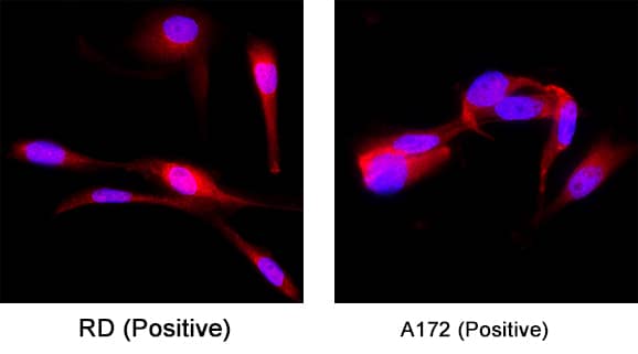 Desmin was detected in immersion fixed RD cells (Positive) and A172 human glioblastoma cell line (Positive) using Mouse Anti-Human Desmin Monoclonal Antibody (Catalog # mab11607) at 8 µg/ml for 3 hours at room temperature. Cells were stained using the NorthernLights™ 557-conjugated Anti-Mouse IgG Secondary Antibody (red; Catalog # NL007) and counterstained with DAPI (blue). Specific staining was localized to the cytoplasm and nucleus. View our protocol for Fluorescent ICC Staining of Cells on Coverslips.