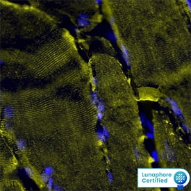 Desmin was detected in immersion fixed paraffin-embedded sections of human Skeletal Muscle using Mouse Anti-Human Desmin Monoclonal Antibody (Catalog # MAB11607) at 1ug/mL at 37 ° Celsius for 4 minutes. Before incubation with the primary antibody, tissue underwent an all-in-one dewaxing and antigen retrieval preprocessing using PreTreatment Module (PT Module) and Dewax and HIER Buffer H (pH 9; Epredia Catalog # TA-999-DHBH). Tissue was stained using the Alexa Fluor™ 555 Goat anti-Mouse IgG Secondary Antibody at 1:100 at 37 ° Celsius for 2 minutes. (Yellow; Lunaphore Catalog # DR555MS) and counterstained with DAPI (blue; Lunaphore Catalog # DR100).Specific staining was localized to the cytoplasm and membrane. Protocol available in COMET™ Panel Builder.